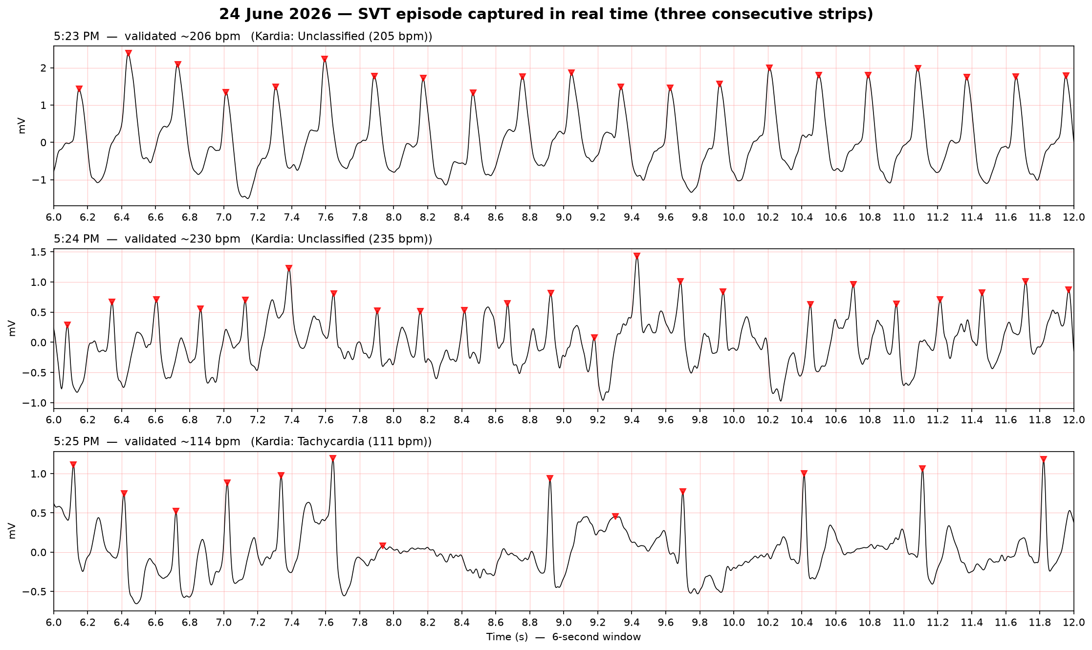 The 24 June episode across three consecutive strips (6-second windows). Top: ~205 BPM, regular and organised. Middle: ~235 BPM, still organised. Bottom: irregular and slowing — the episode breaking up and self-terminating ("sudden offset").