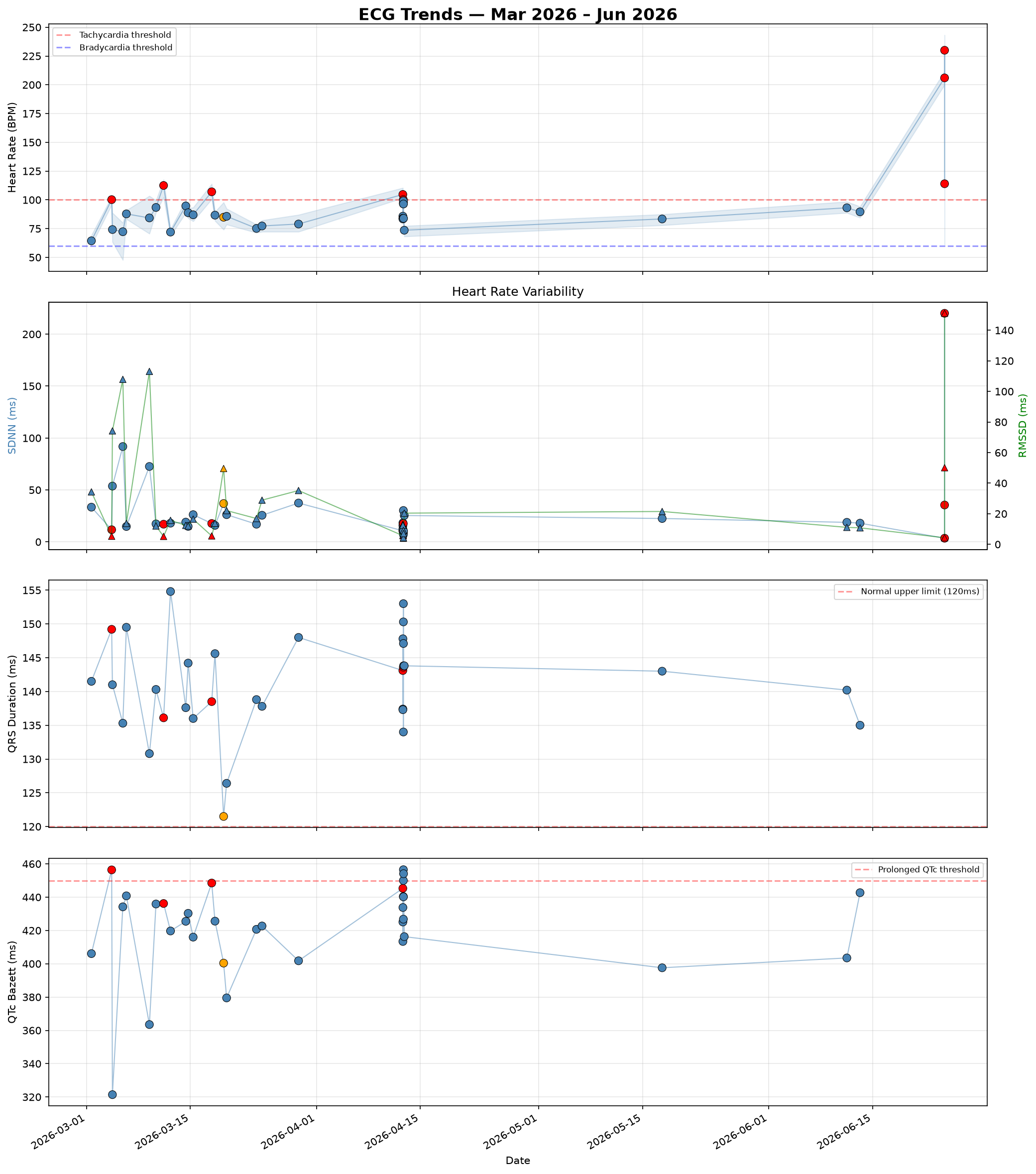Heart rate, HRV, QRS and QTc across all 36 recordings. The 24 June episode is the dramatic spike at the right-hand edge of the top panel.